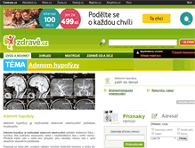 Tablet Screenshot of adenom-hypofyzy.zdrave.cz