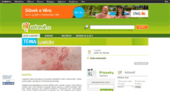 Desktop Screenshot of lupenka.zdrave.cz