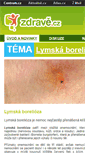 Mobile Screenshot of lymska-borelioza.zdrave.cz